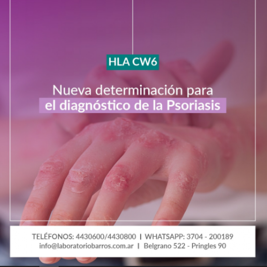 La psoriasis es una enfermedad inflamatoria