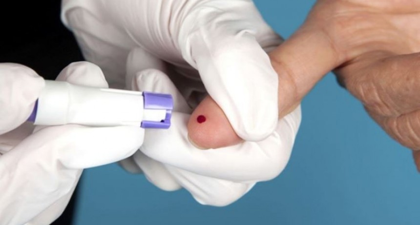 Remarcan importancia de hacerse el test o prueba del VIH-SIDA
